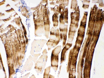 Anti-ACTN3 Antibody