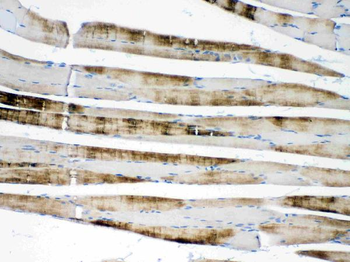 Anti-ACTN3 Antibody