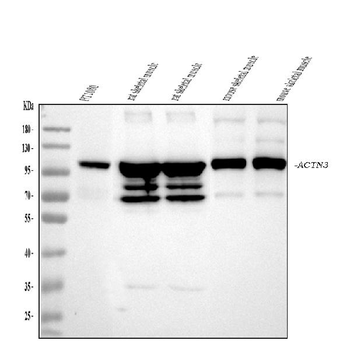 Anti-ACTN3 Antibody