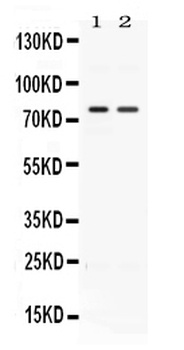 Activin Receptor Type IIA/ACVR2A Antibody