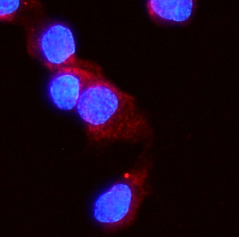Anti-Activin Receptor Type IIA/ACVR2A Antibody