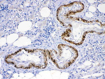 Anti-Activin Receptor Type IIA/ACVR2A Antibody