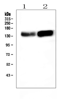 Anti-ADAMTS13 Antibody