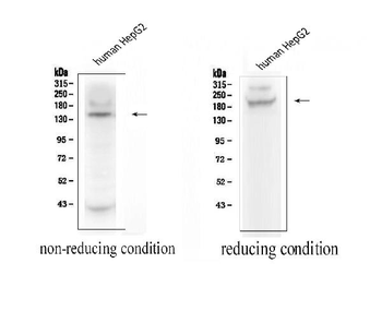Anti-ADAMTS13 Antibody