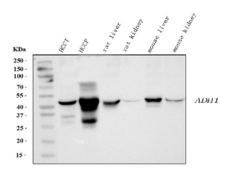 Alcohol Dehydrogenase/ADH1A Antibody