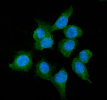 Anti-Alcohol Dehydrogenase/ADH1A Antibody