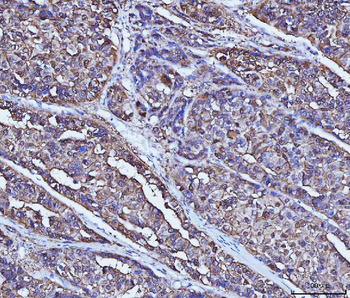 Anti-Alcohol Dehydrogenase/ADH1A Antibody