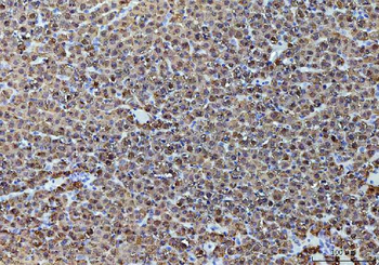 Anti-Alcohol Dehydrogenase/ADH1A Antibody