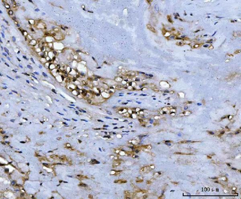 Anti-ADK Antibody