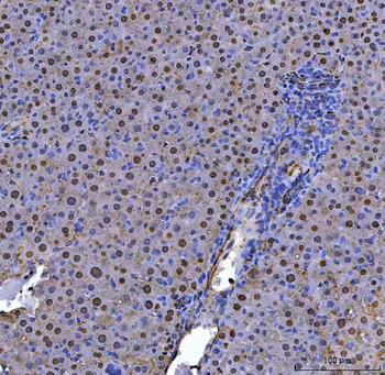 Anti-ADK Antibody