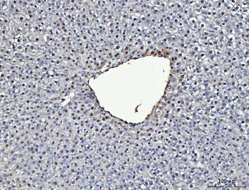 Anti-ADK Antibody