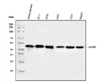 Anti-ADK Antibody