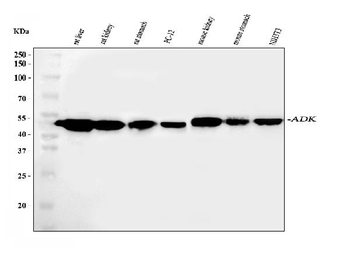 Anti-ADK Antibody