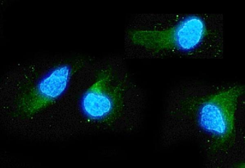 Anti-ADO Antibody