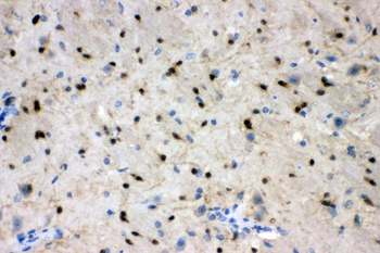 Anti-ADO Antibody