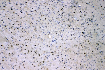 Anti-ADO Antibody