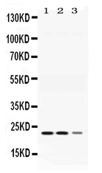 Adenylate Kinase 1/AK1 Antibody