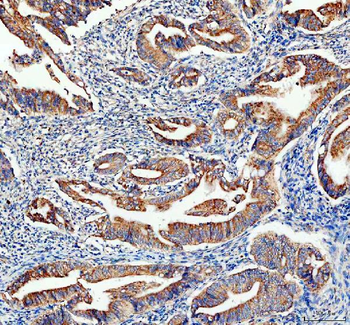 Anti-Adenylate Kinase 1/AK1 Antibody