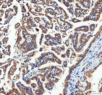 Anti-Adenylate Kinase 1/AK1 Antibody