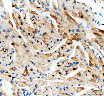 Anti-Adenylate Kinase 1/AK1 Antibody