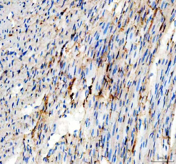 Anti-Adenylate Kinase 1/AK1 Antibody