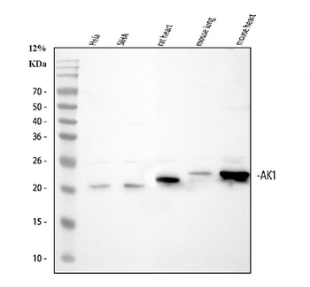 Anti-Adenylate Kinase 1/AK1 Antibody