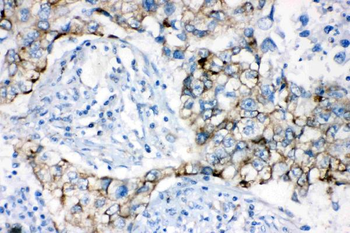 Anti-AK2 Antibody