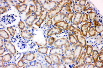 Anti-AK2 Antibody