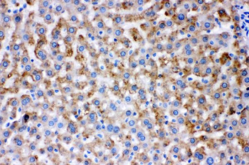 Anti-AK2 Antibody
