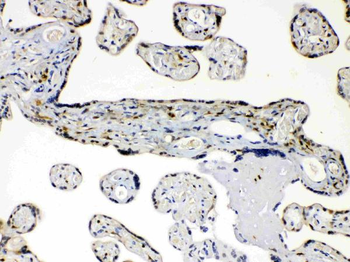 Anti-AKR1B1 Antibody