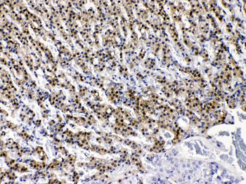 Anti-AKR1B1 Antibody