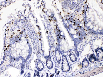 Anti-AKR1B1 Antibody