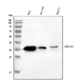 Anti-AKR1B1 Antibody