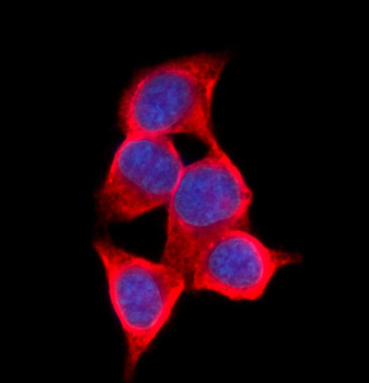 Anti-AKR1C1/C2 Antibody