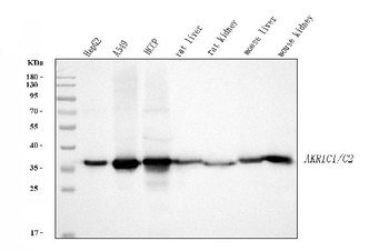 Anti-AKR1C1/C2 Antibody
