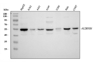 Anti-ALDH1B1 Antibody
