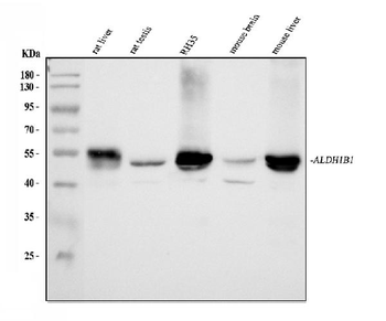 Anti-ALDH1B1 Antibody