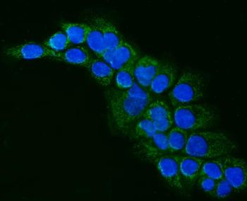 Anti-ALDH1B1 Antibody
