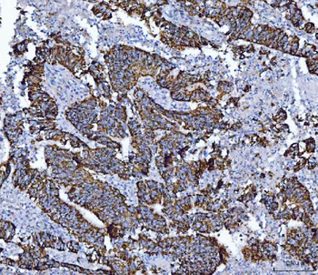 Anti-ALDH1B1 Antibody