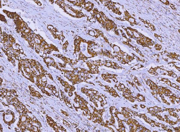 Anti-ALDH1B1 Antibody