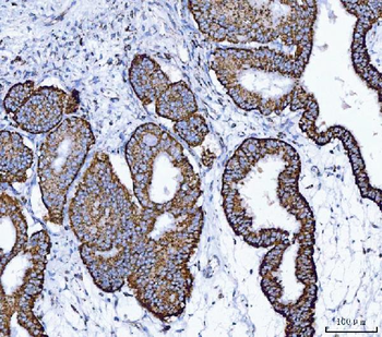 Anti-ALDH1B1 Antibody