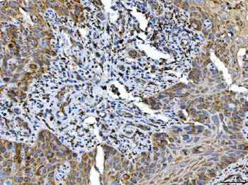 Anti-ALDH1B1 Antibody