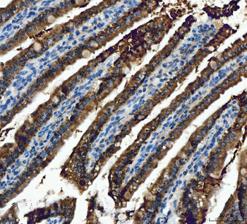 Anti-ALDH1B1 Antibody