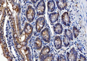 Anti-ALDH1B1 Antibody
