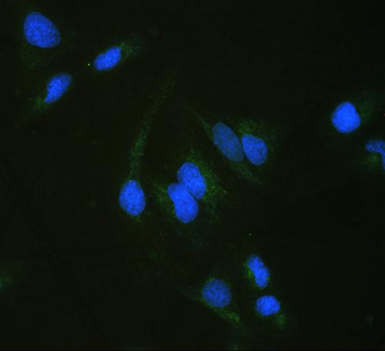 Anti-ALDH7A1 Antibody
