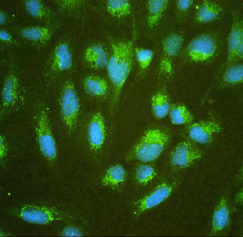 Anti-ALDH7A1 Antibody