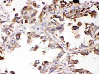 Anti-ALDH7A1 Antibody