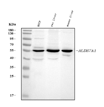 Anti-ALDH7A1 Antibody