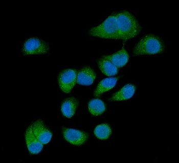 Anti-AMFR Antibody