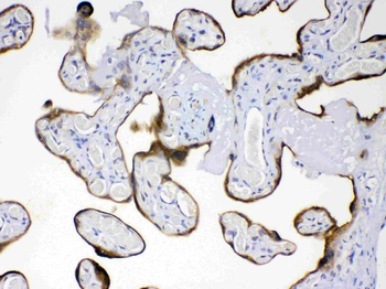 Anti-AMFR Antibody